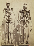 2006BC0576-01
© Victoria and Albert Museum, London
Skeletons, photo Roger Fenton. England, mid-19th century 2006BC0576-01
© Victoria and Albert Museum, London
Skeletons, photo Roger Fenton. England, mid-19th century